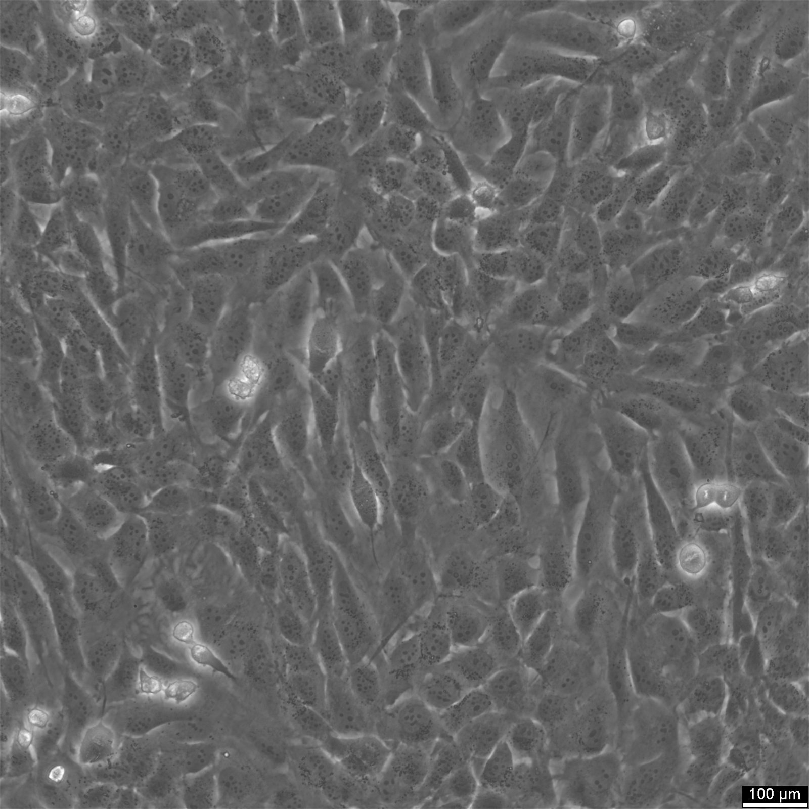 SJSA-1 Cells