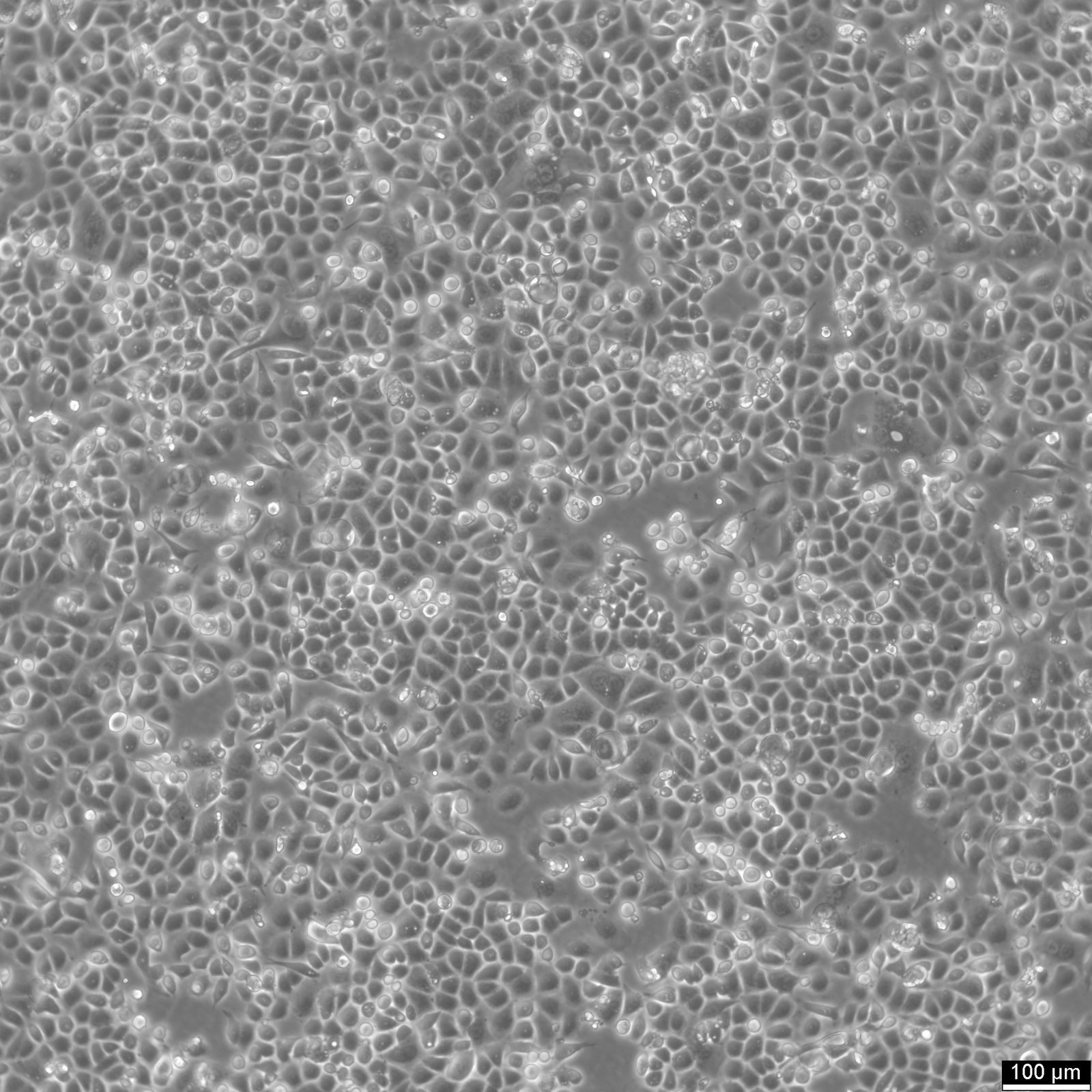 AGS Cells AGS Cells