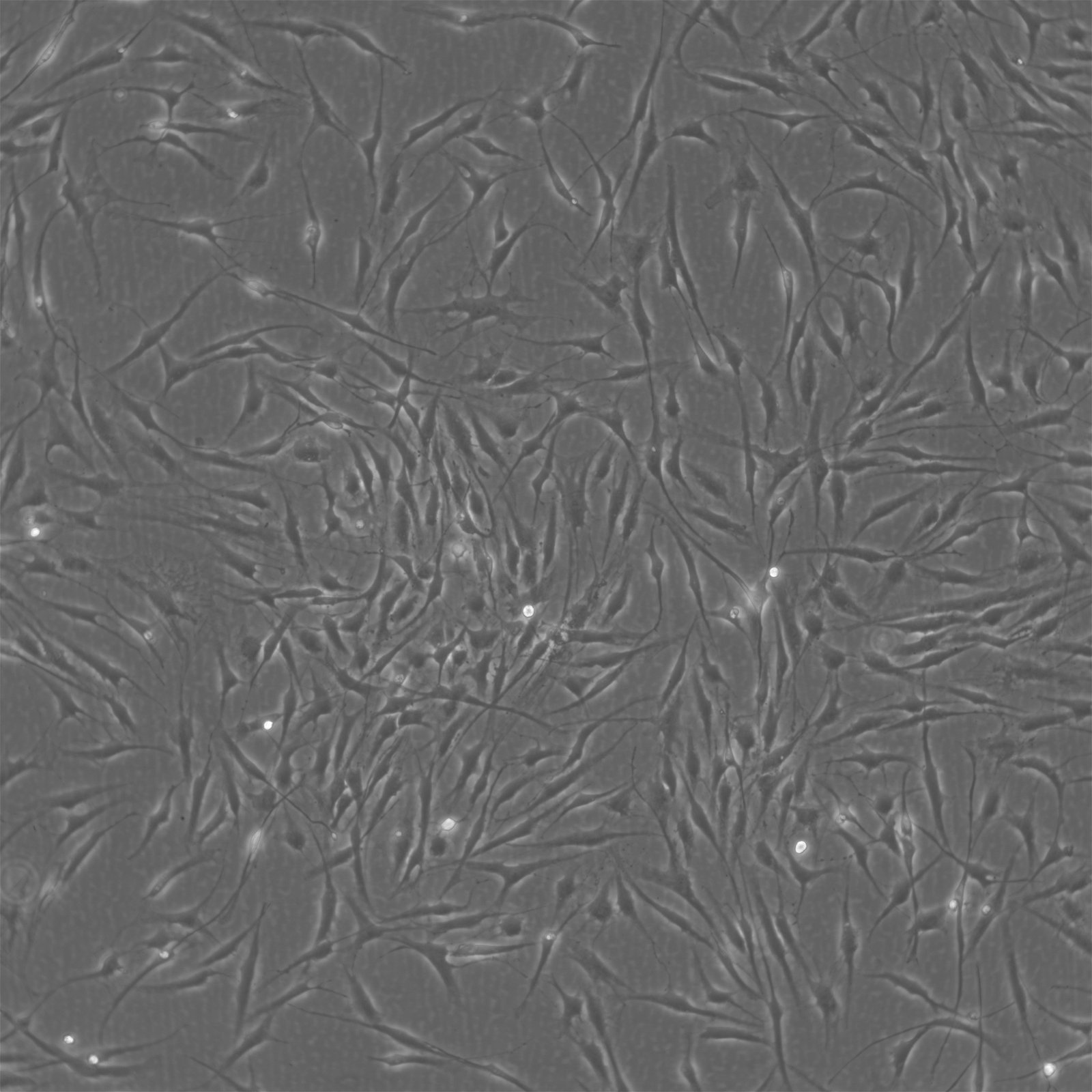 Humane mesenchymale Stammzellen - Knochenmark (HMSC-BM)