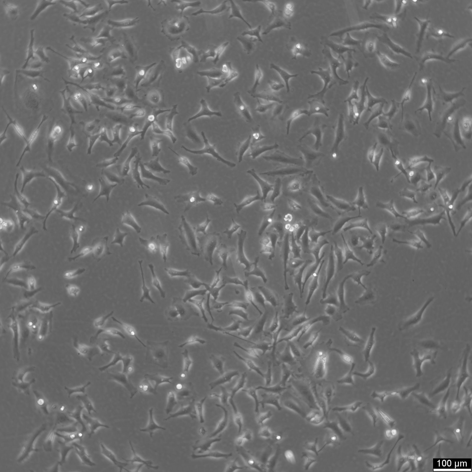 HEp-2 Cells HEp-2 Cells