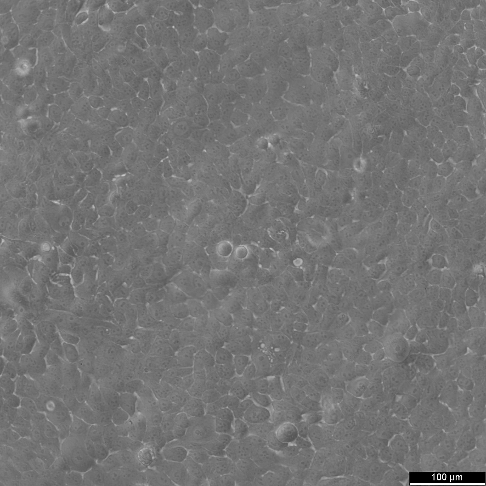 MCF10A Cells