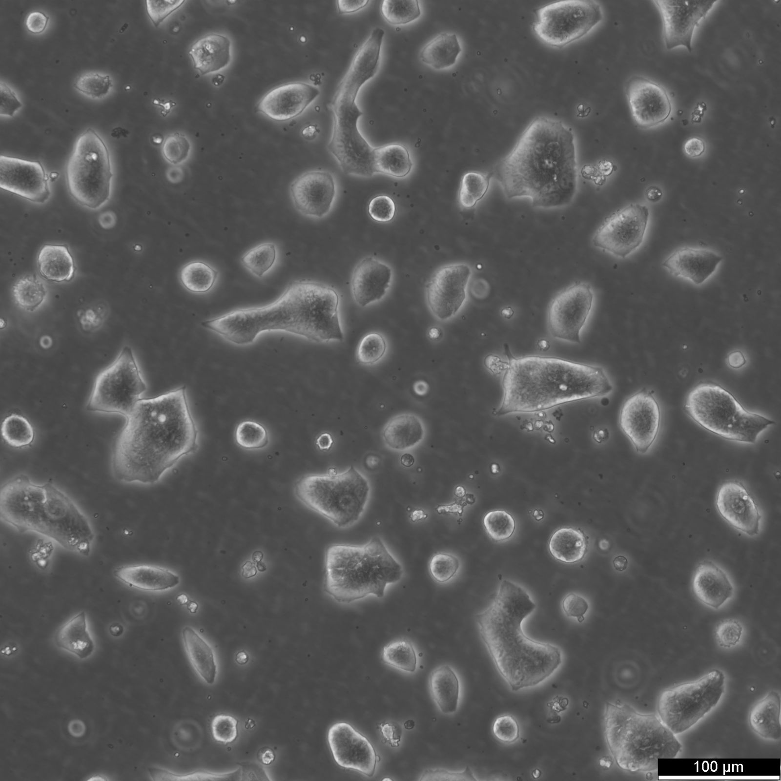 LS174T Cells LS174T Cells