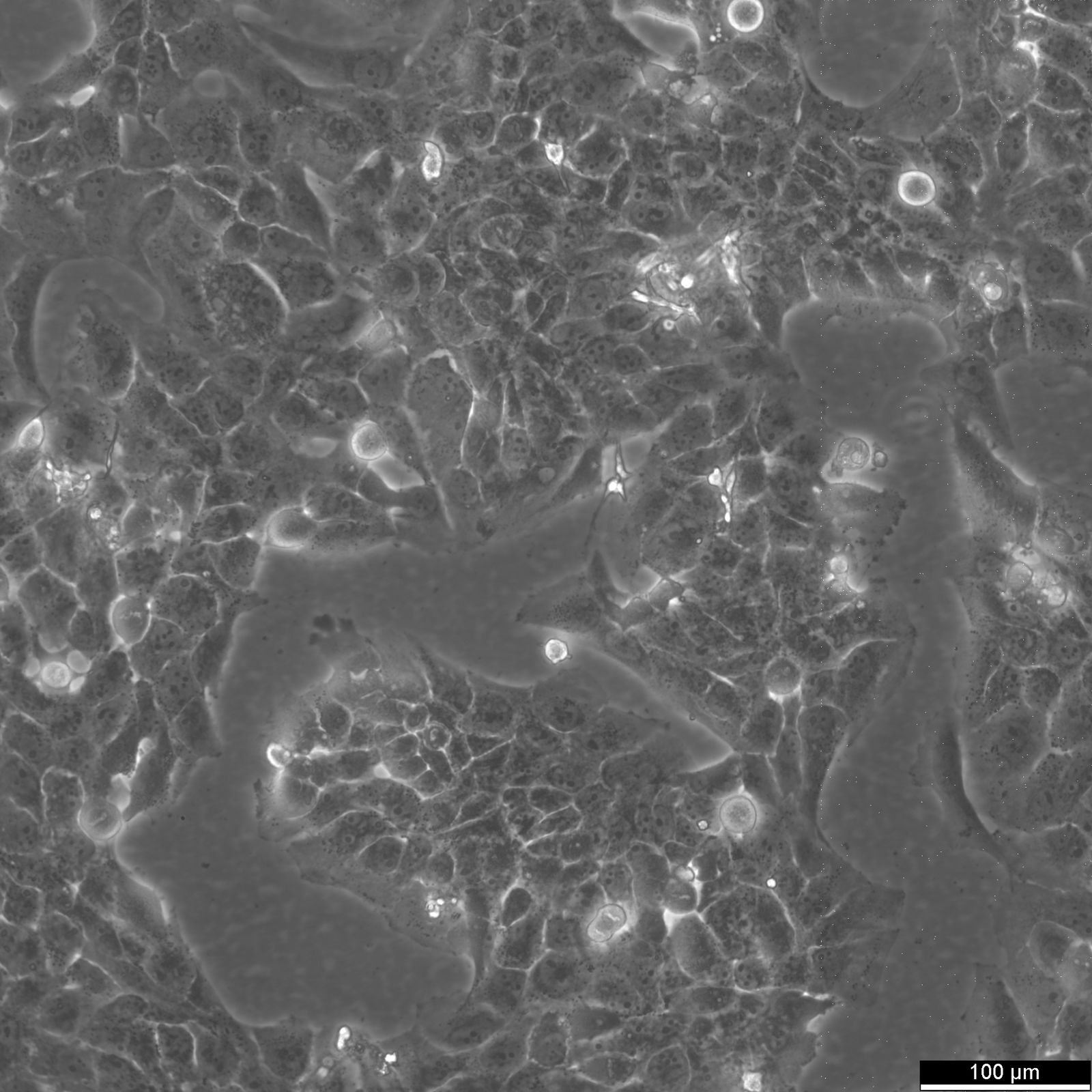 NCI-H2228 Cells NCI-H2228 Cells