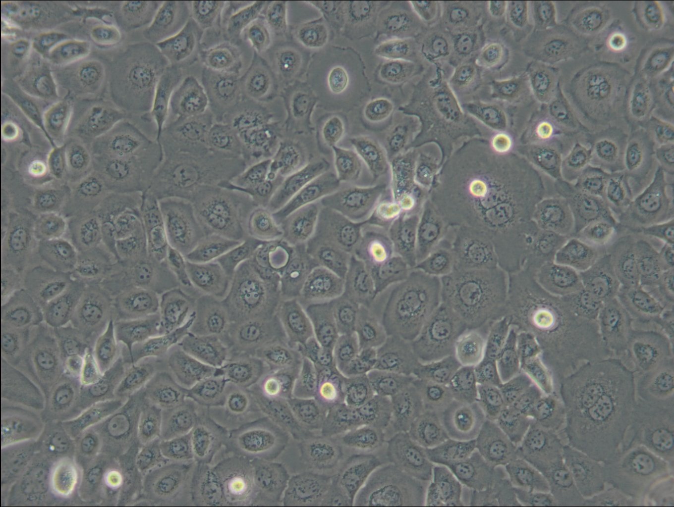 TE-1 Cells