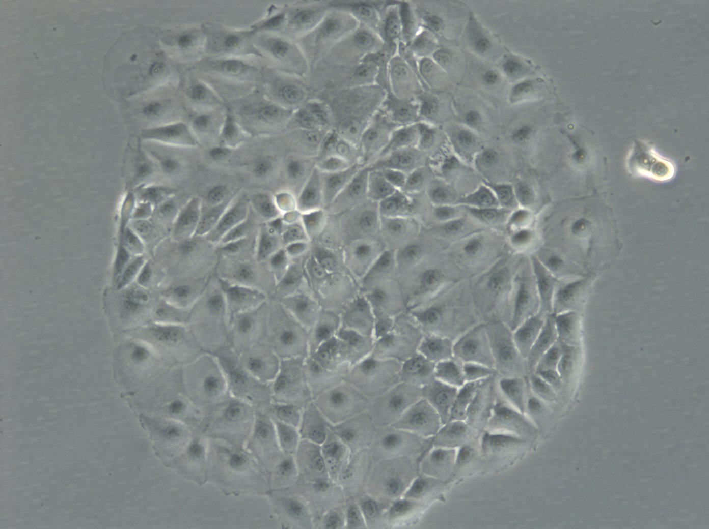 MCF-7-Zellen