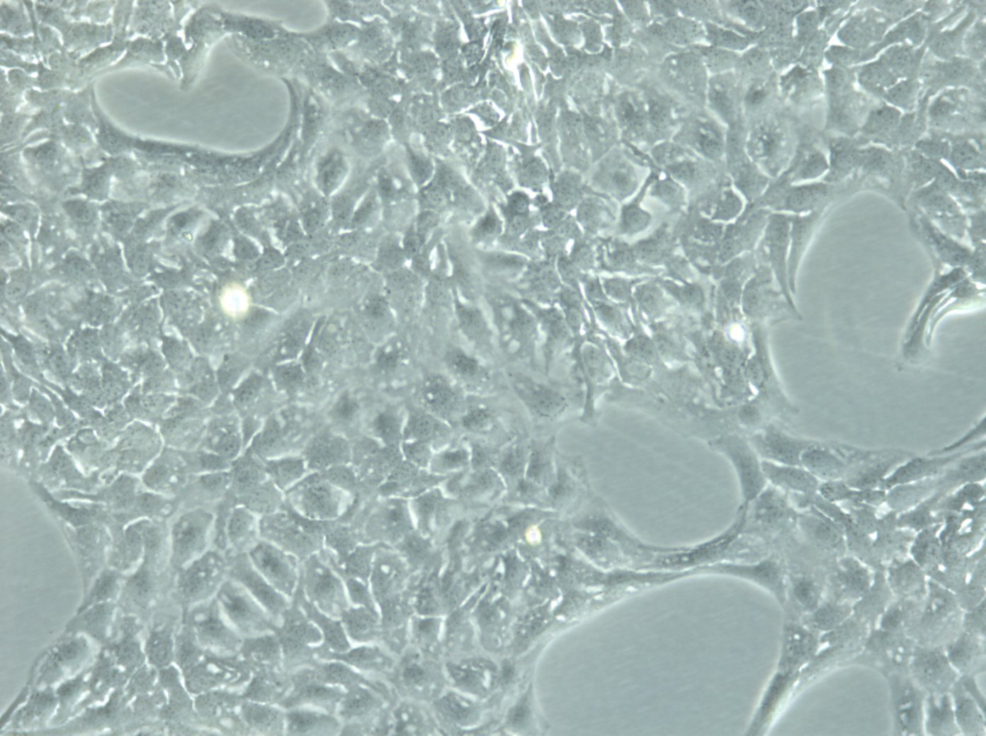 SK-OV-3-Zellen