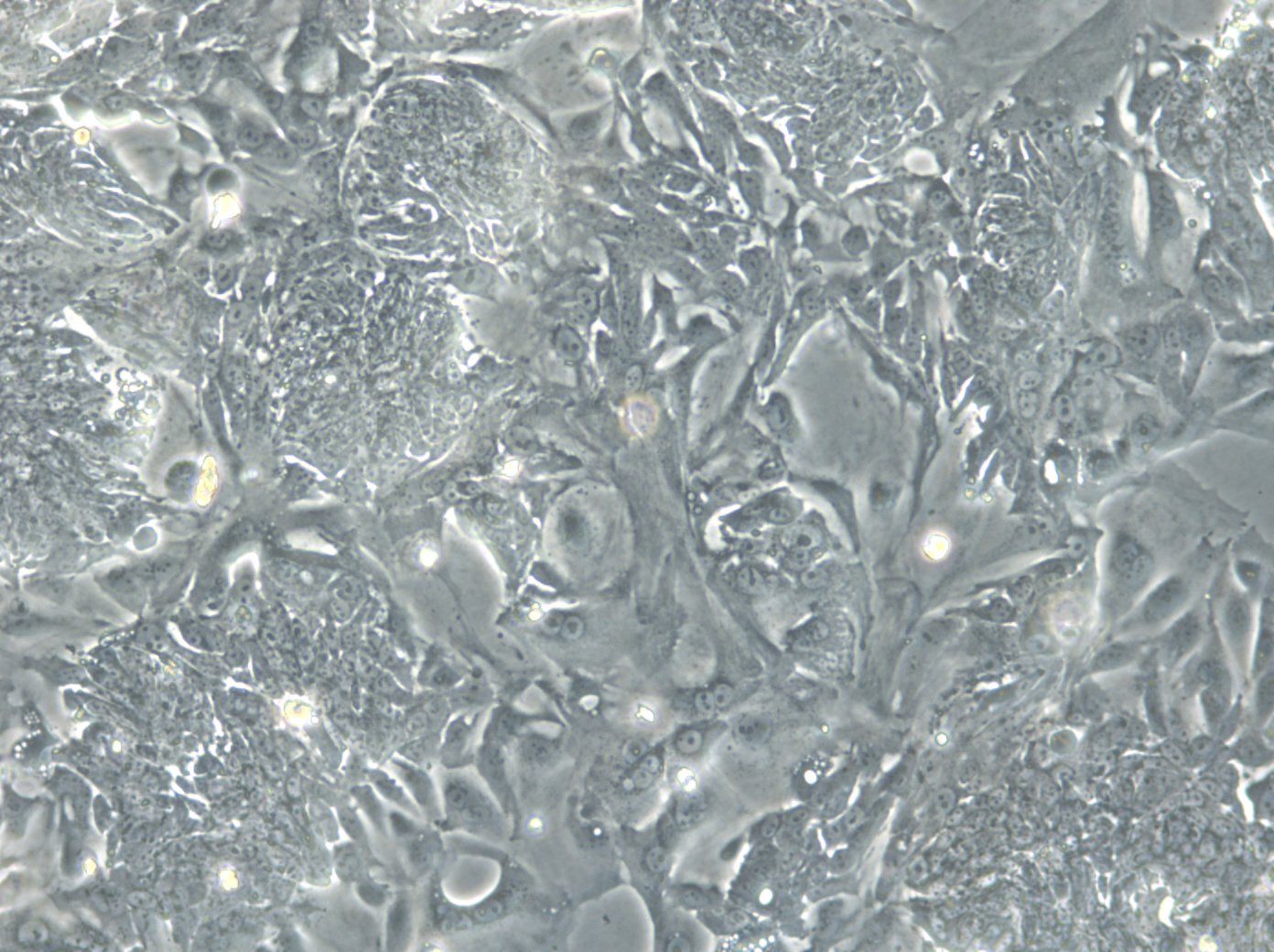 HROC18 Cells