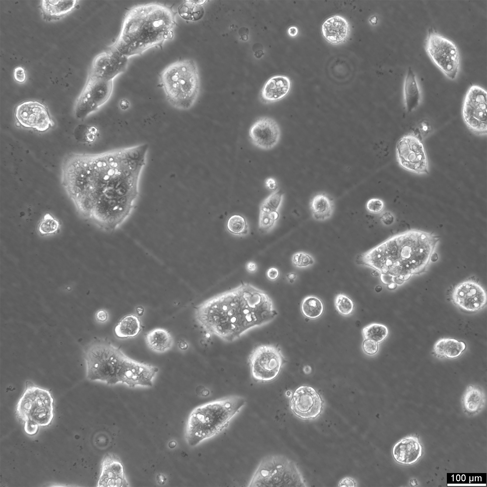 NCI-N87-Zellen