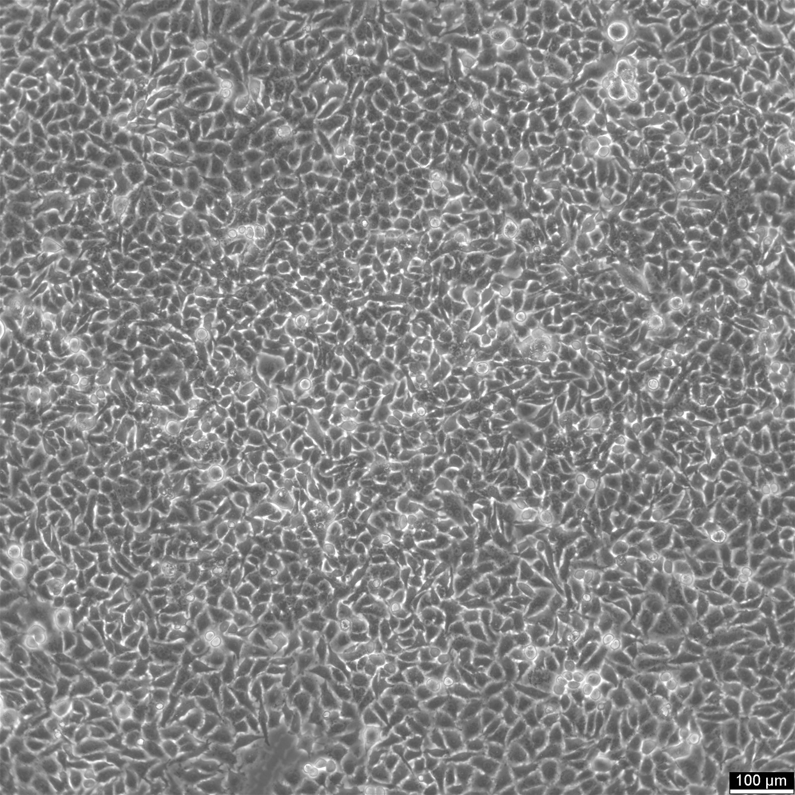 HK-CRISPR-Nup188-mEGFP #11-092 Zellen