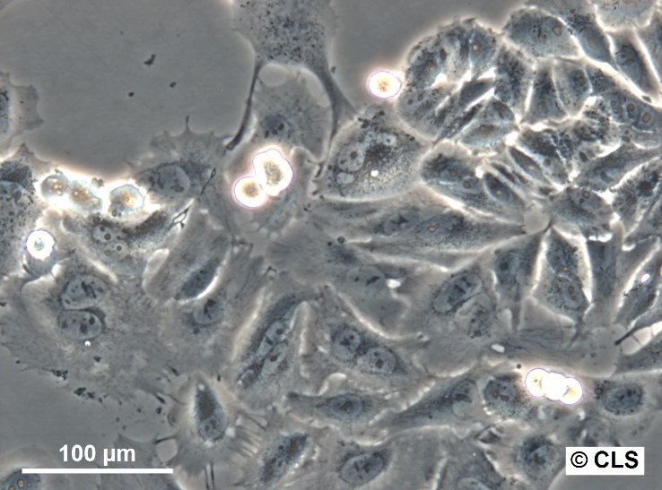 MA-CLS-2-Zellen