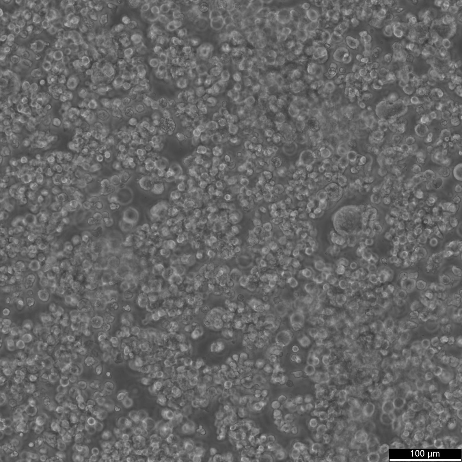 EB1 Cells EB1 Cells