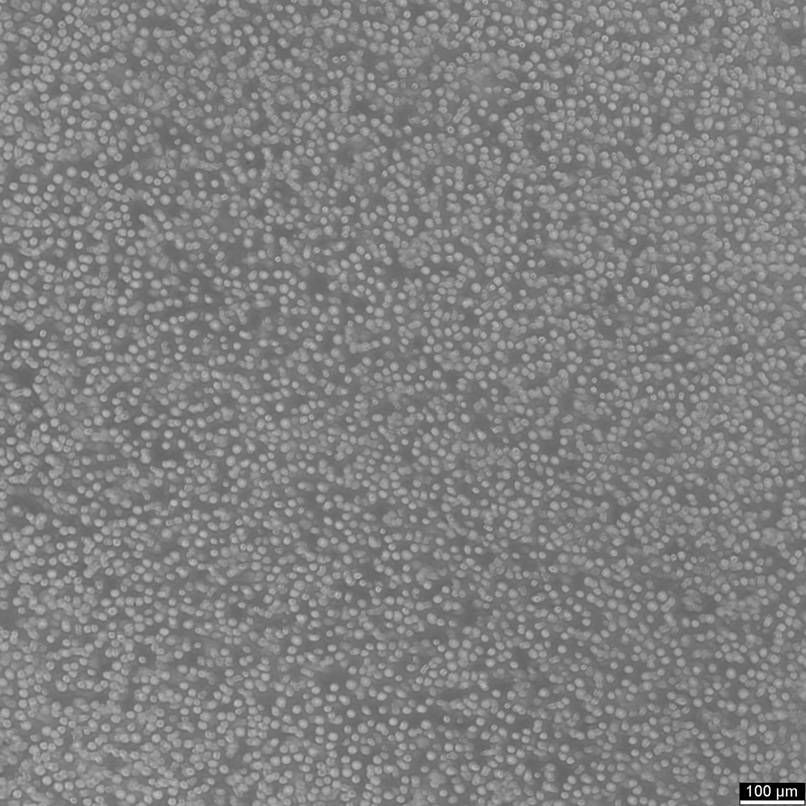 SKW-3 Cells SKW-3 Cells