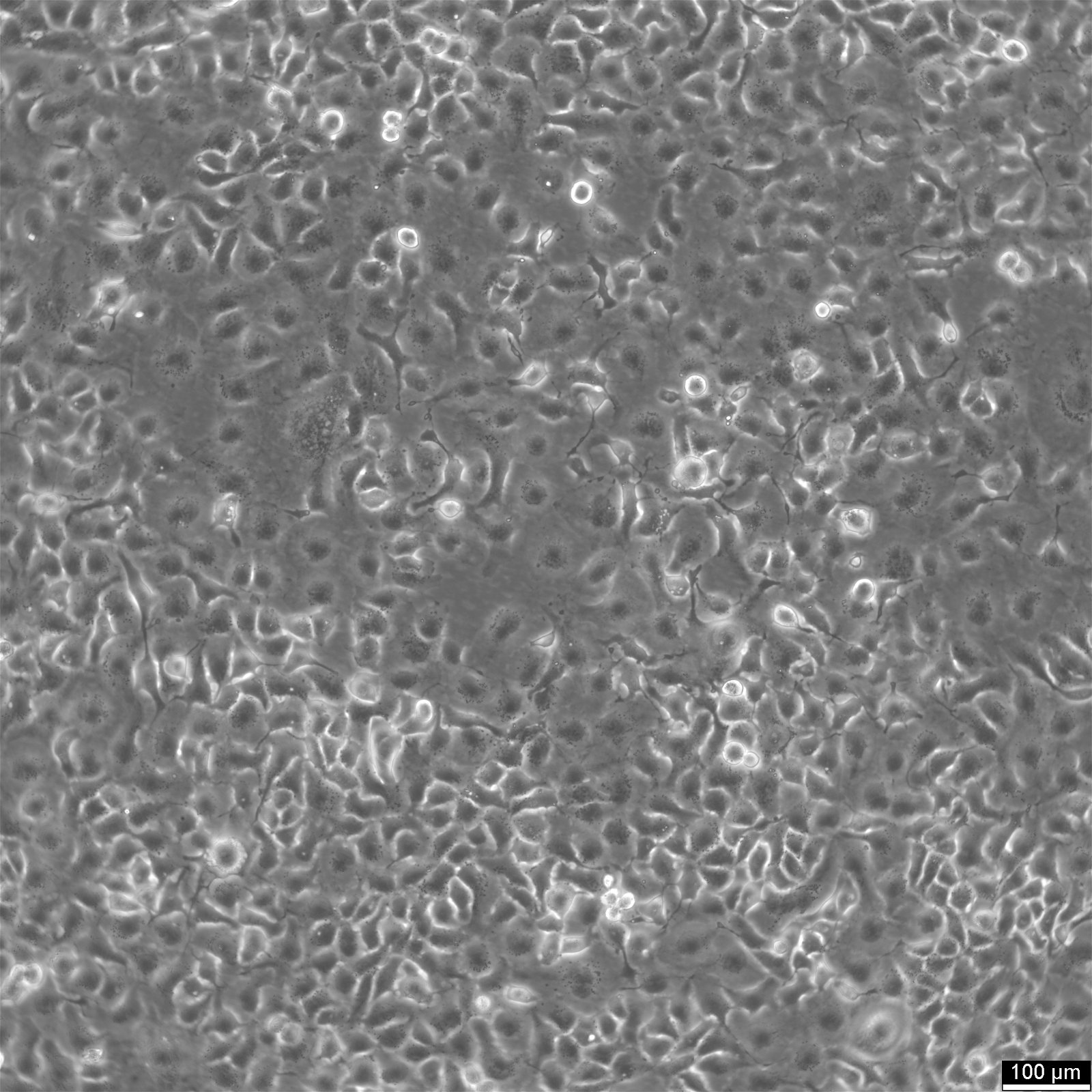 NCI-H661 Cells