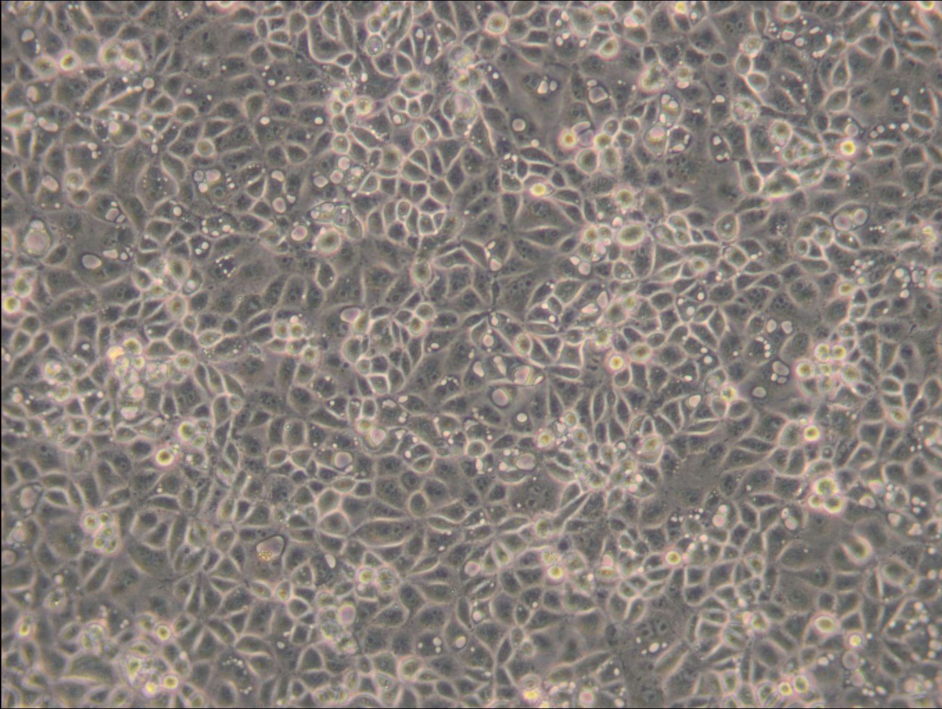 ST Cells