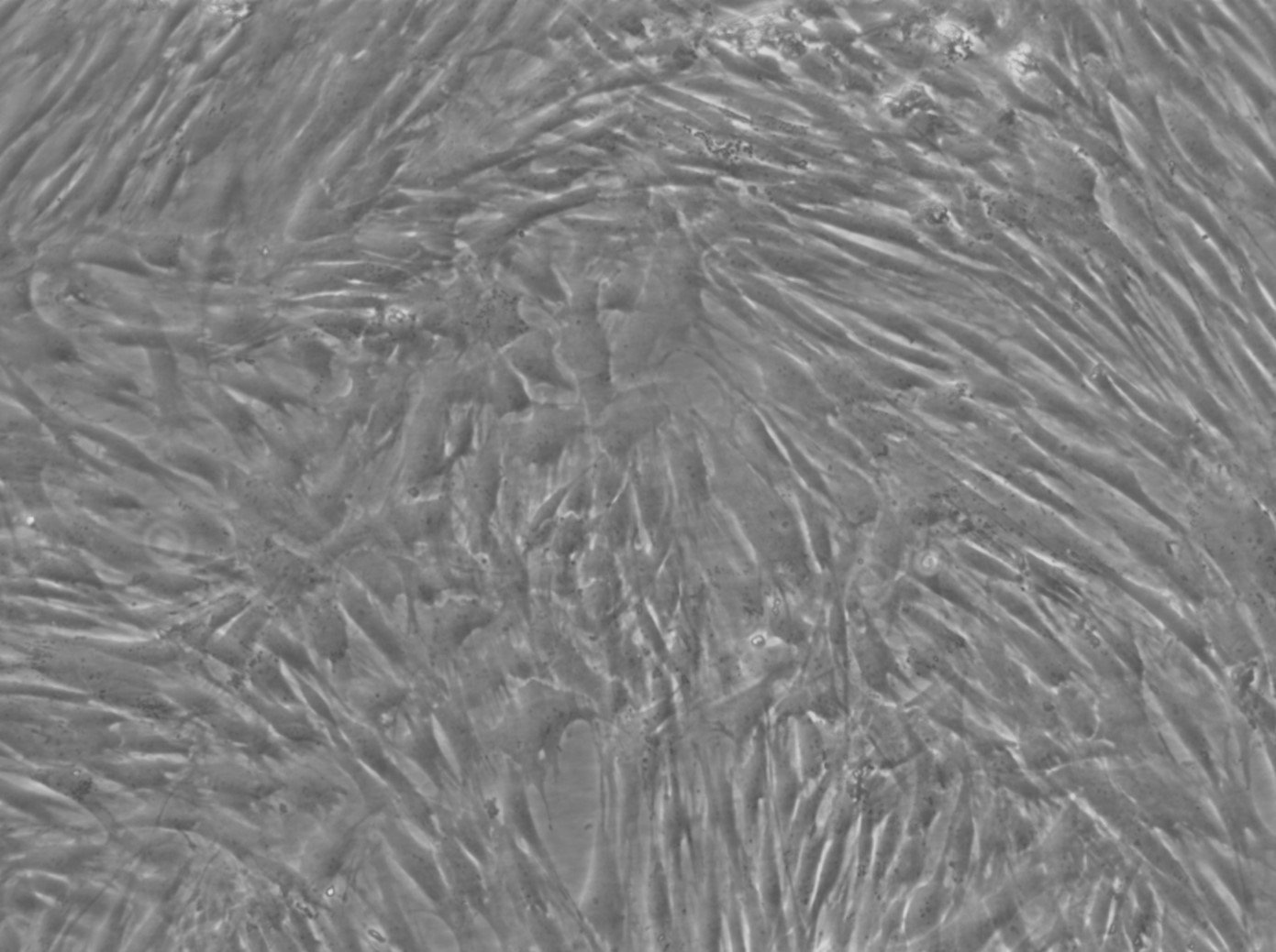 Menschliche Zahnmarkstammzellen (hDPSC) Zellen