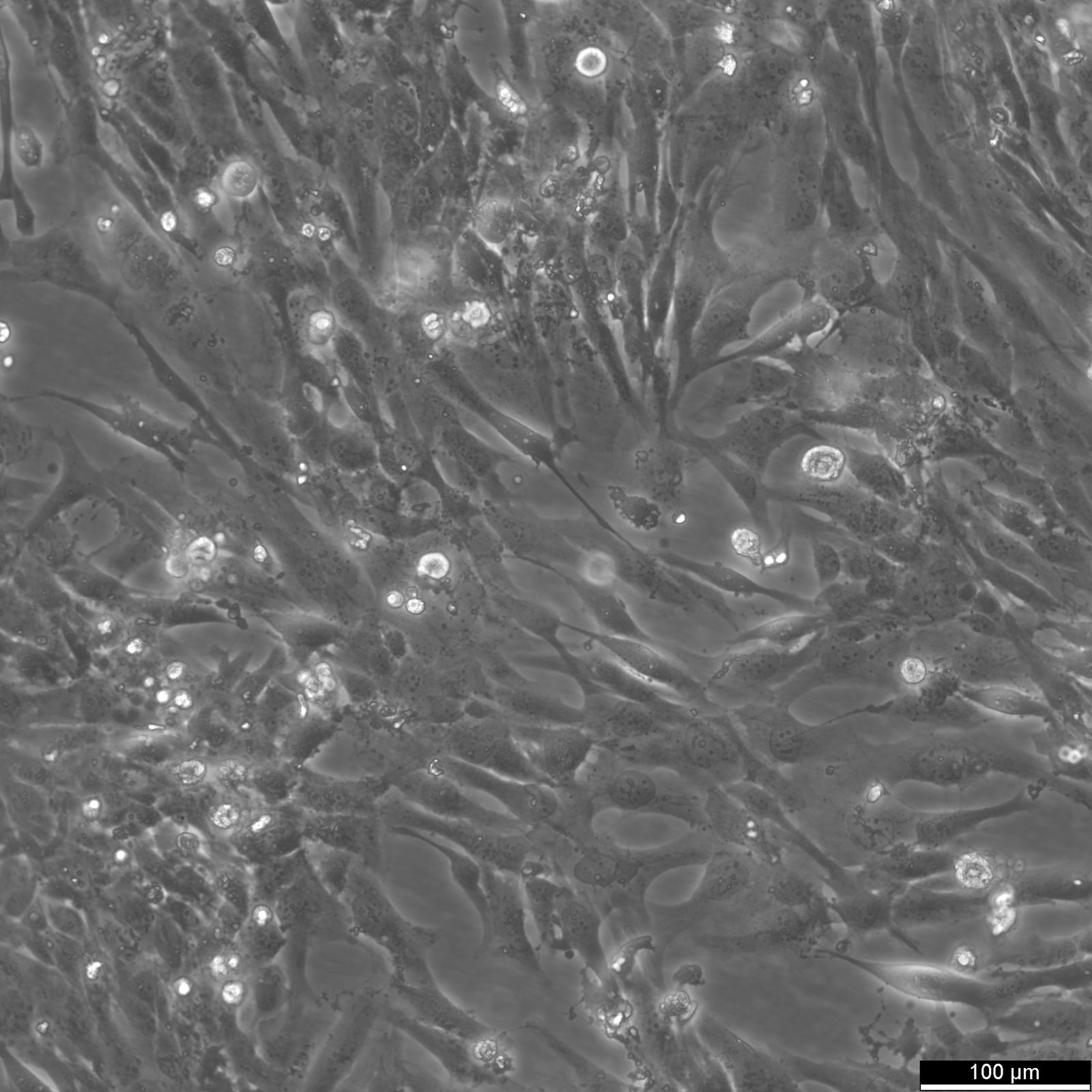 AC16 Cardiomyocyte Cell Line