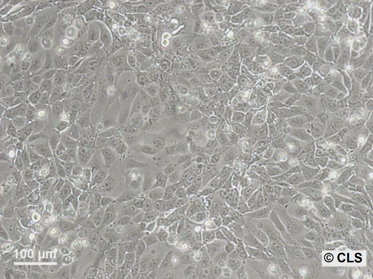 MA-Balb-Zellen