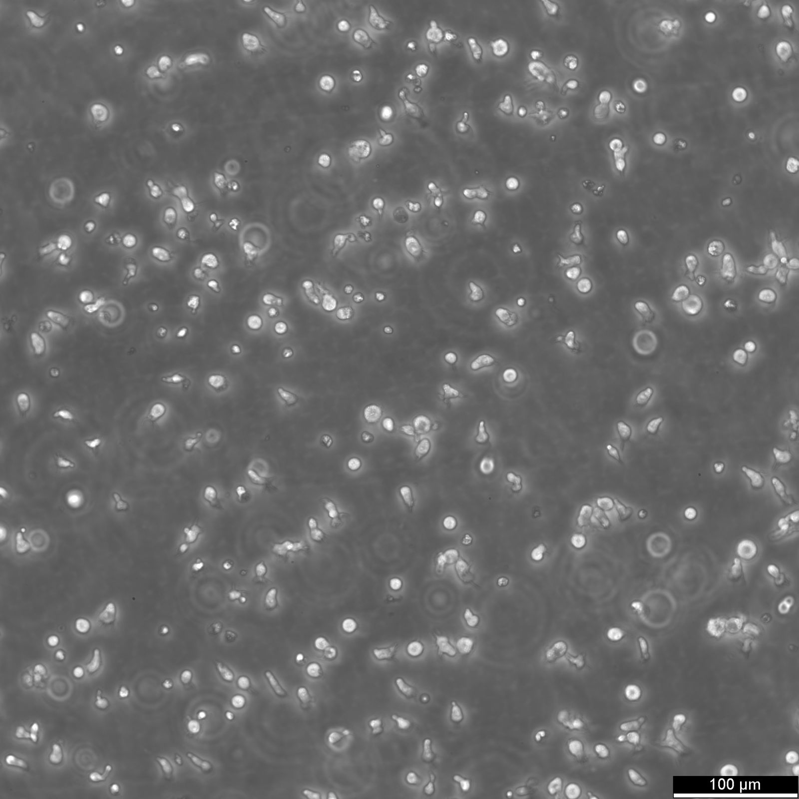 B-LCL-HROC69 Cells B-LCL-HROC69 Cells