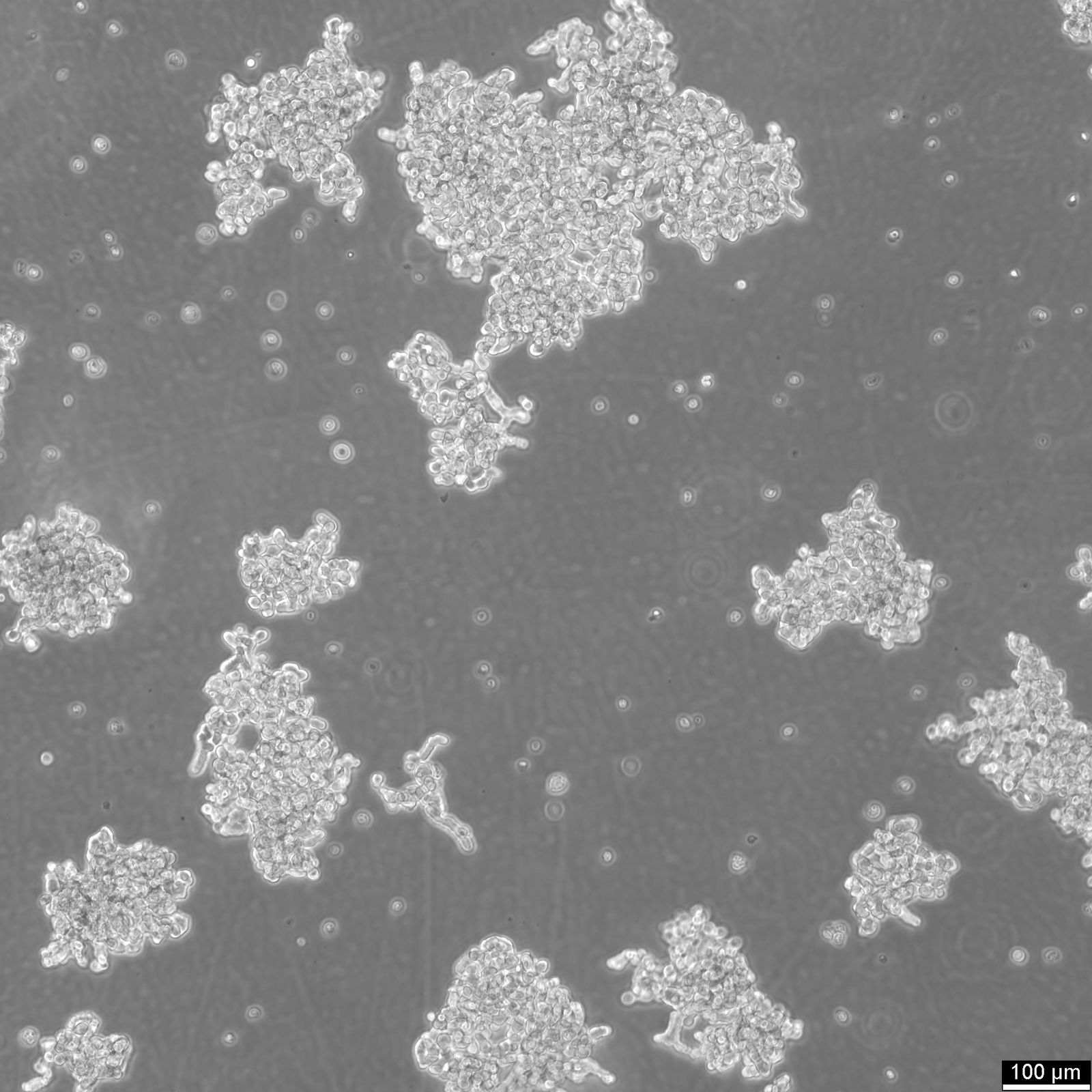 WERI-Rb-1 Cells WERI-Rb-1 Cells