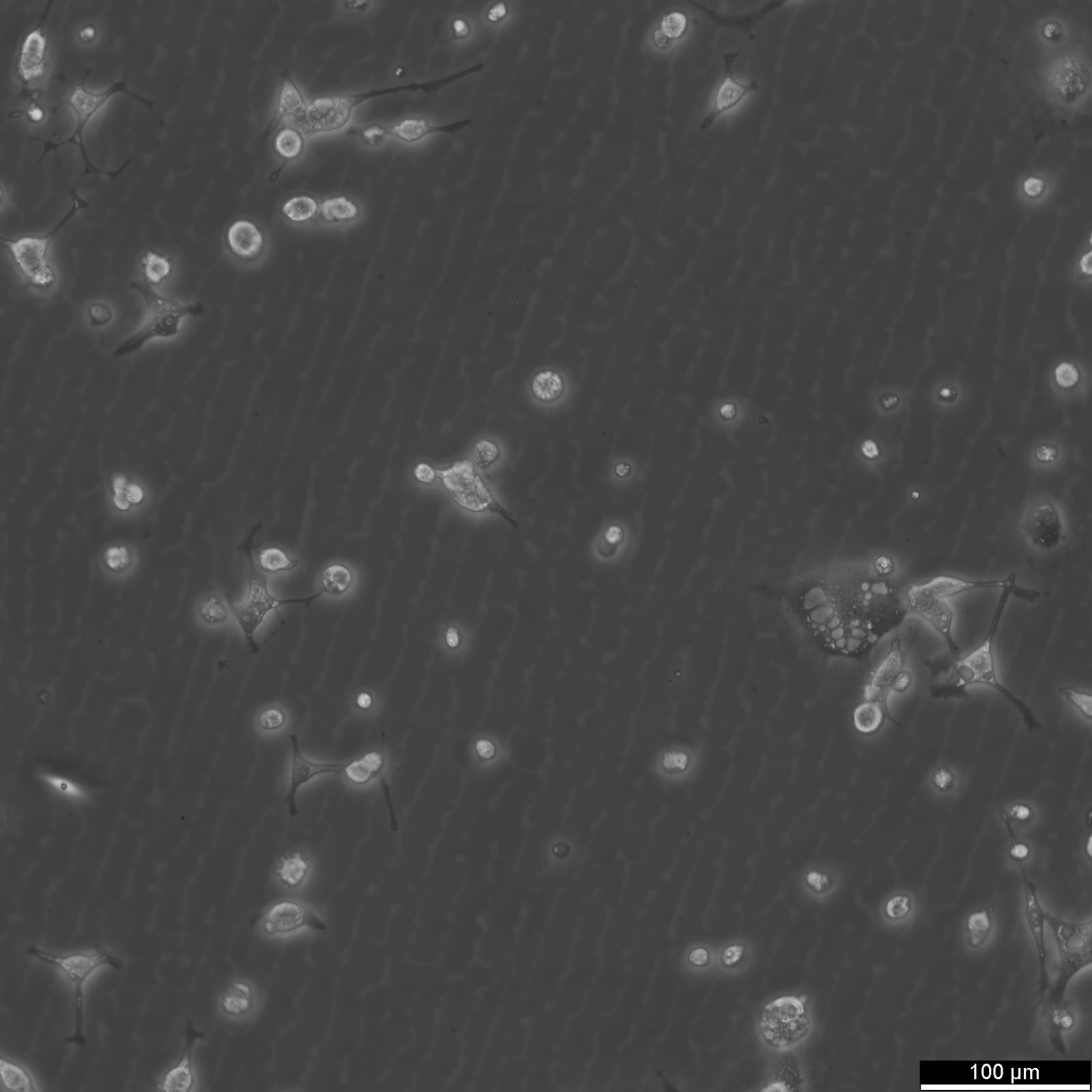 MDA-MB-436 Cells MDA-MB-436 Cells