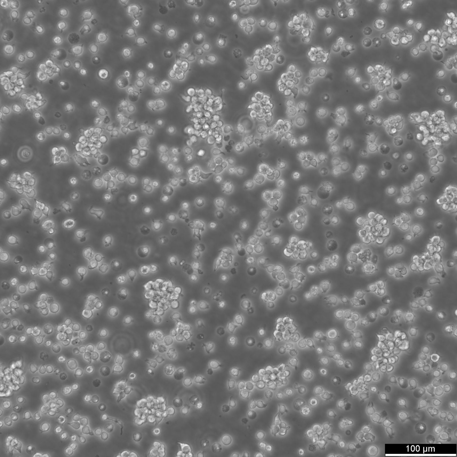 Jurkat E6.1 Cells