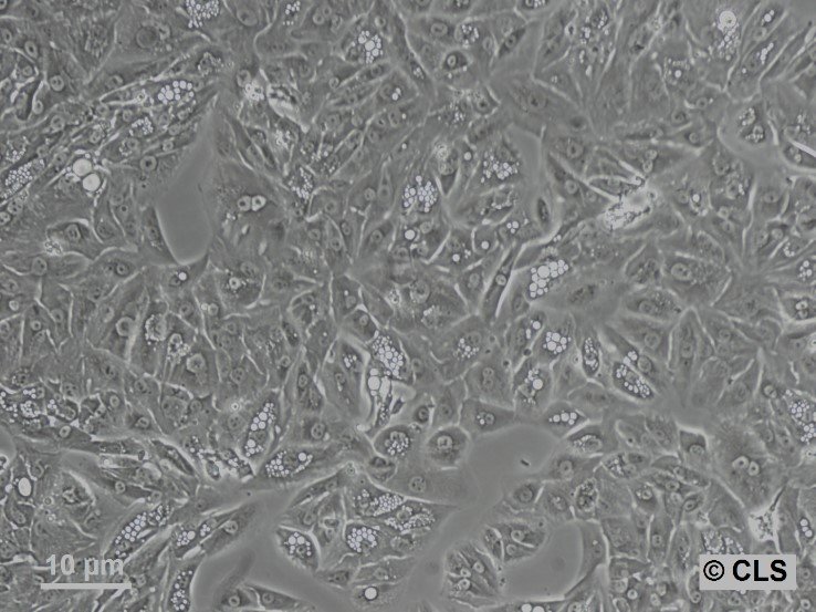 Cellules RCC-MF