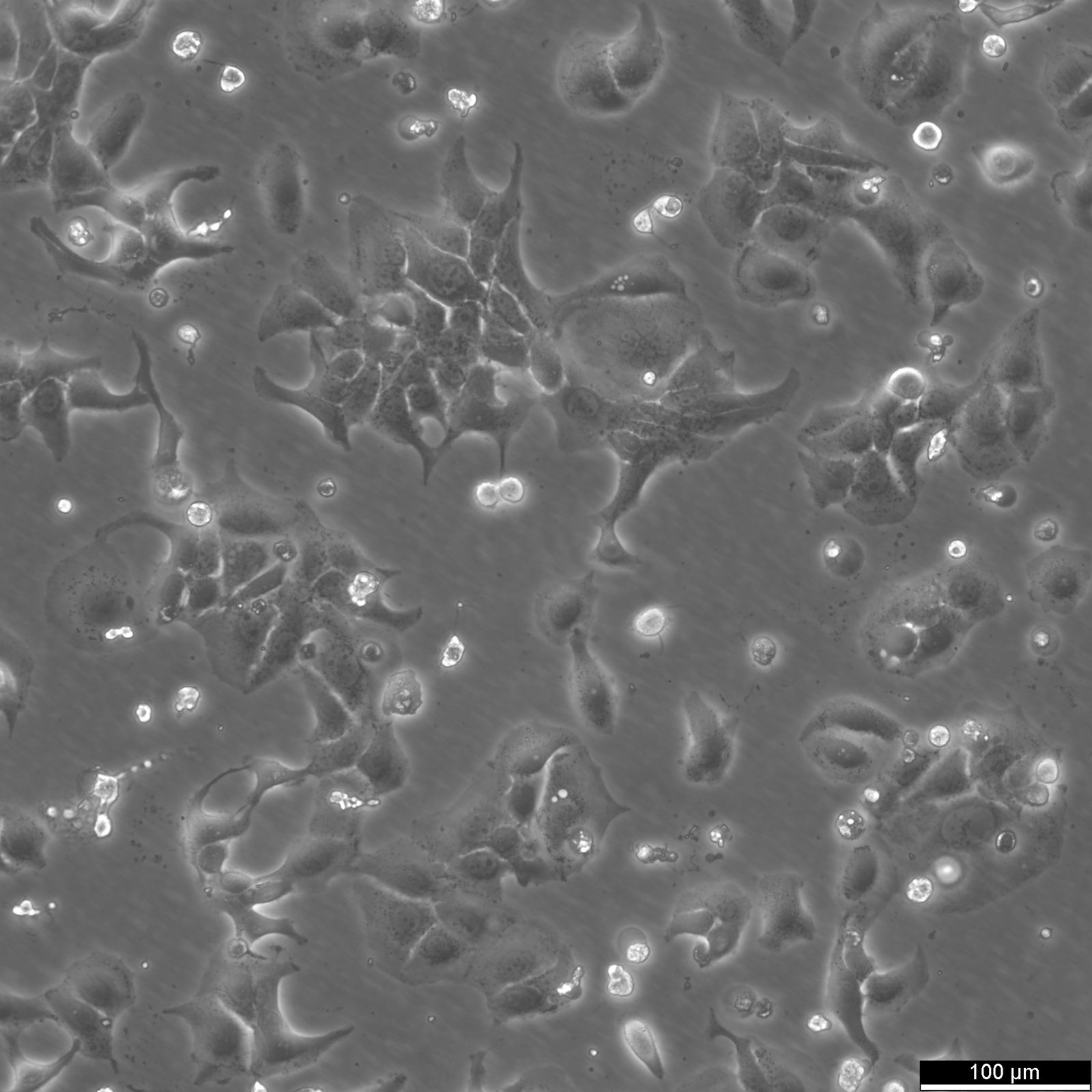 BT-20 Cells