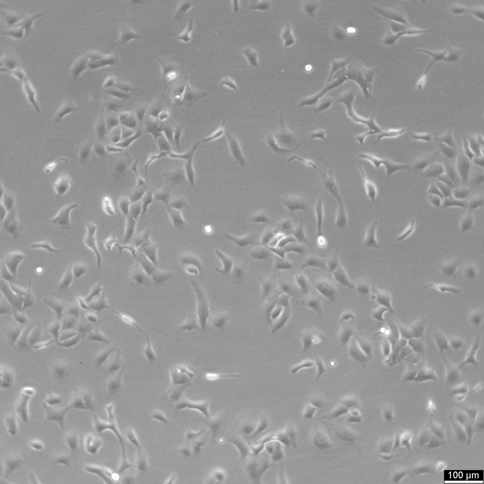 SK-OV-3 Cells