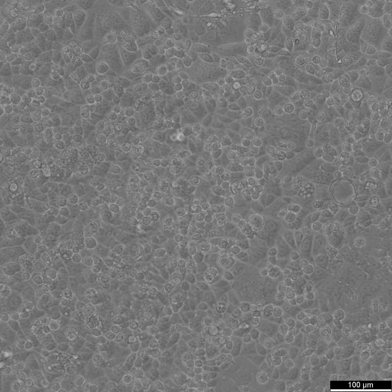 AGS Cells AGS Cells