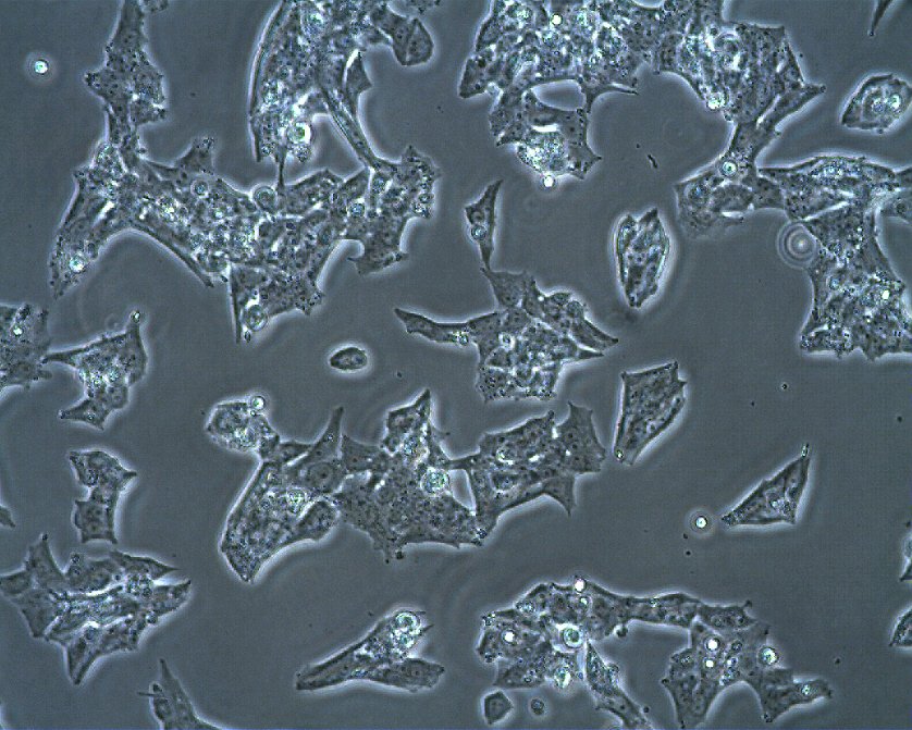 NCI-H295R-Zellen