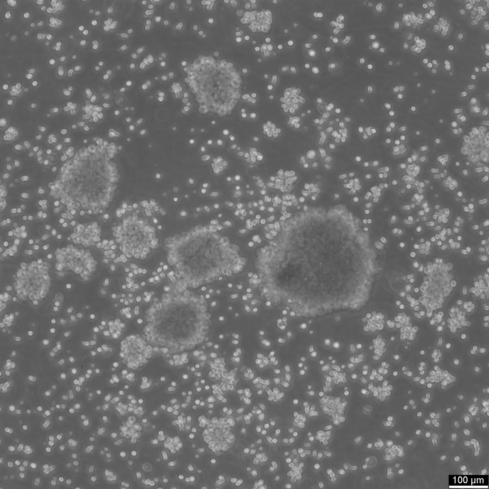B-LCL-HROC69 Cells B-LCL-HROC69 Cells