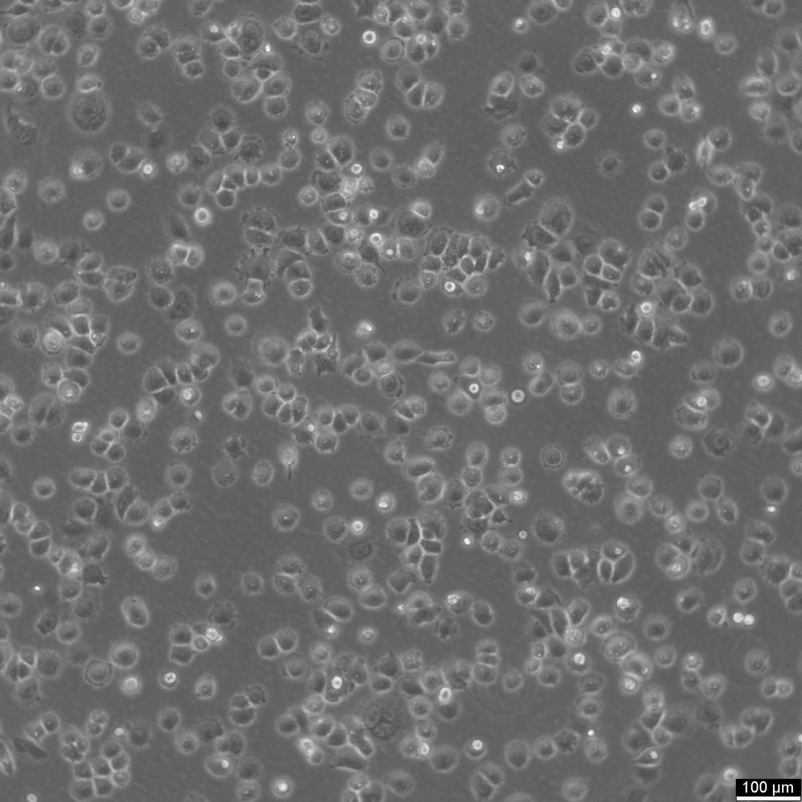 SW-13 Cells SW-13 Cells