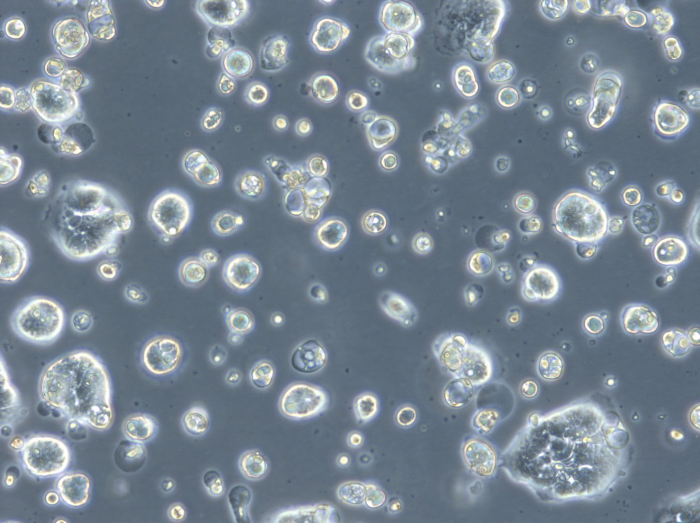 Cellules HROC183