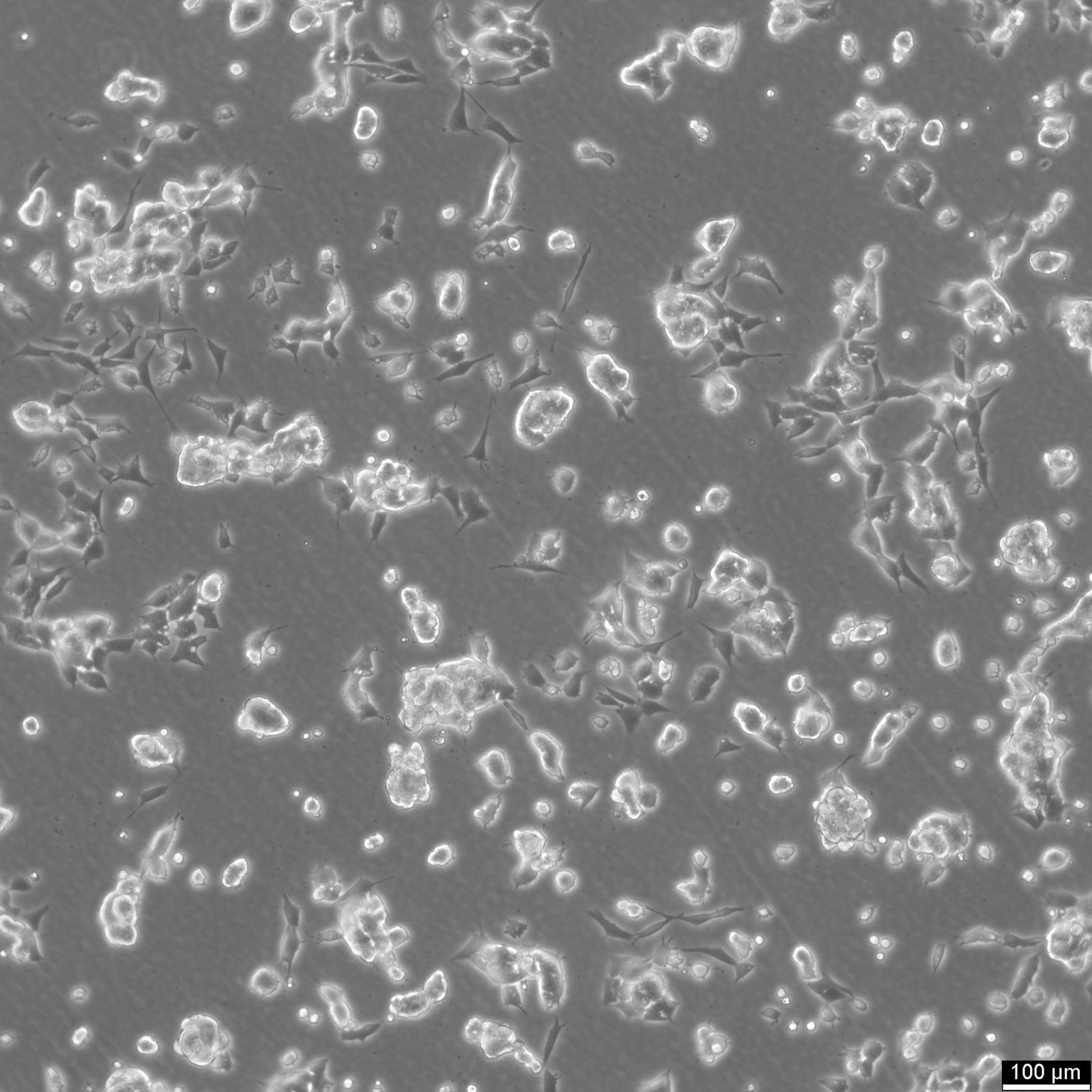 SK-ES-1 Cells
