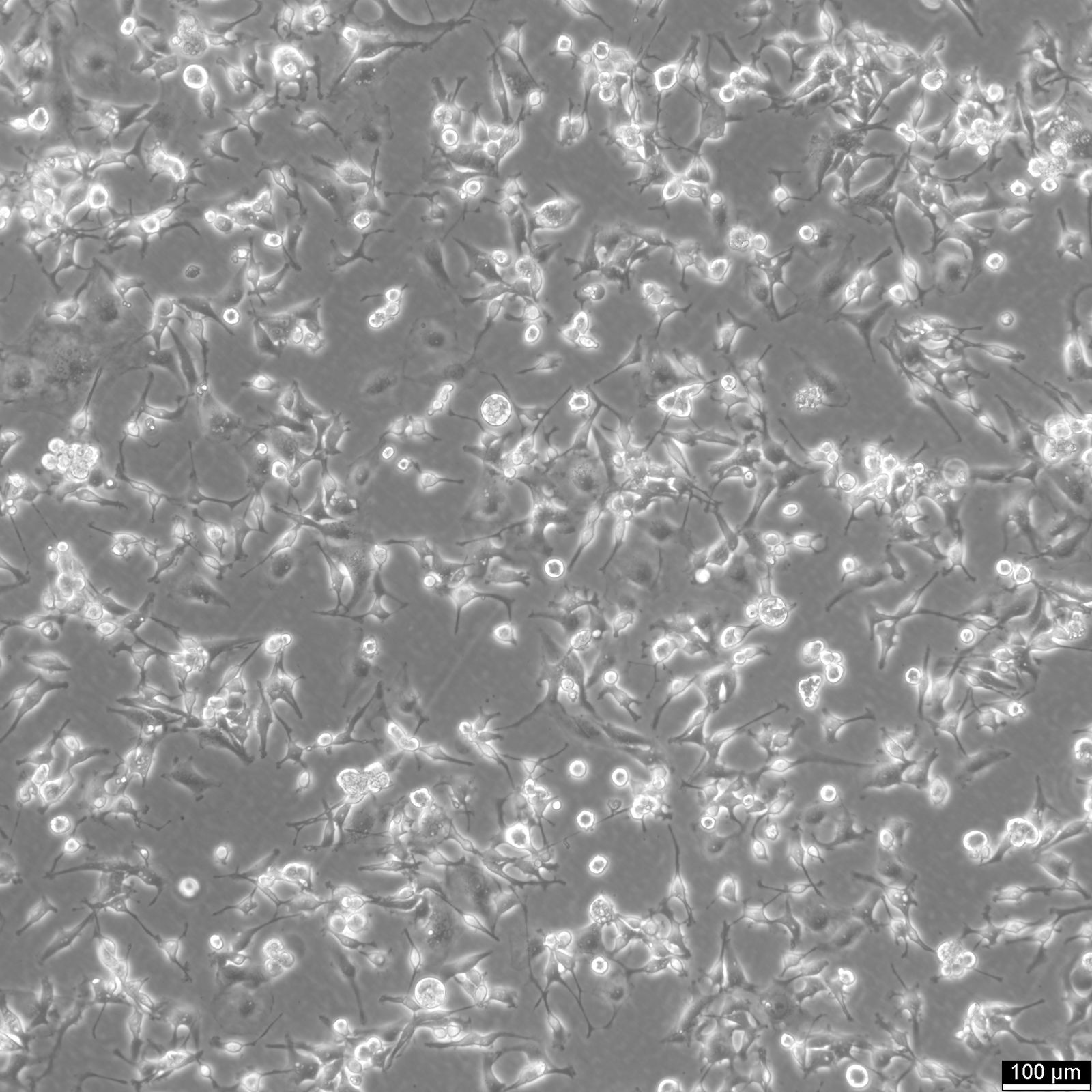 MDA-MB-436 Cells MDA-MB-436 Cells