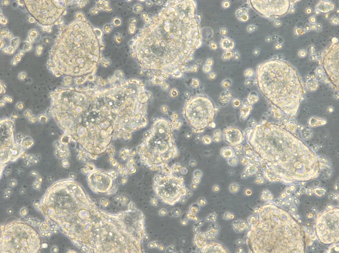 HROC278 T0 M1 Cells