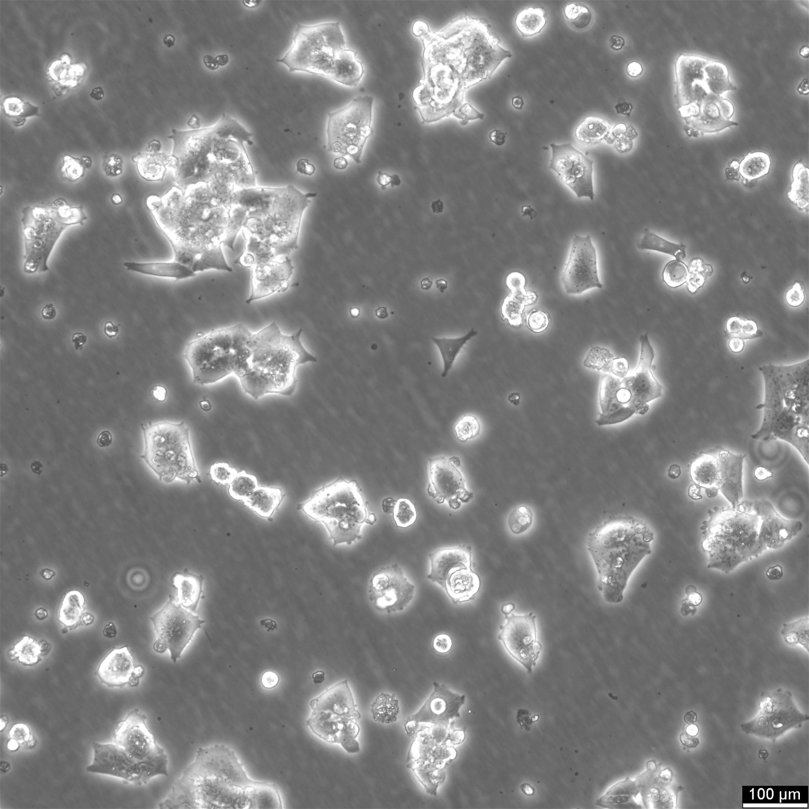 NCI-H520 Cells