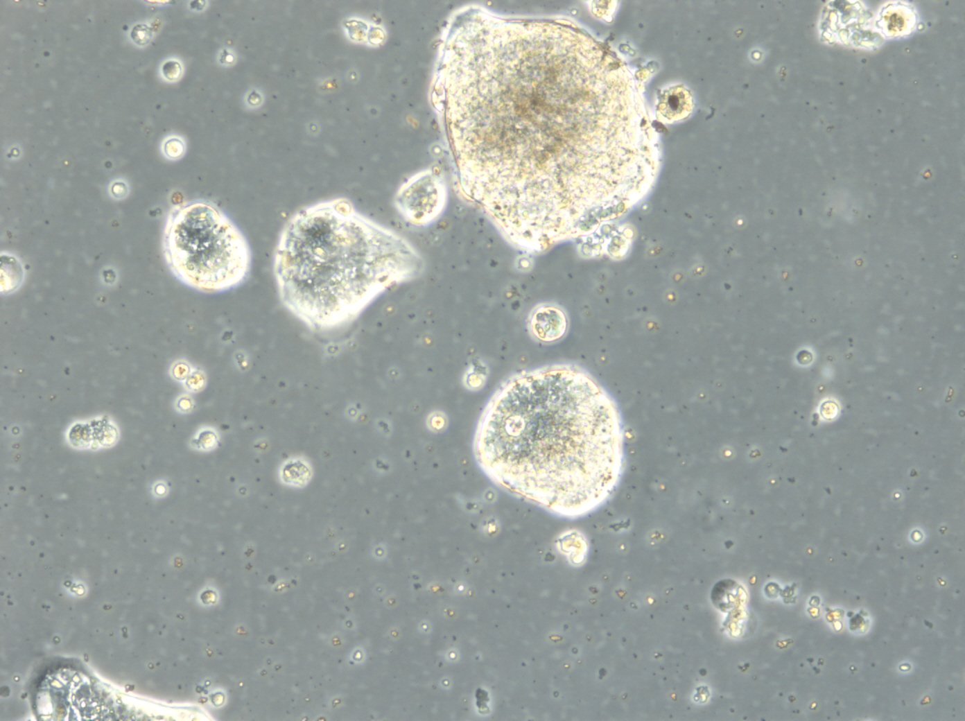 HROC357 Cells