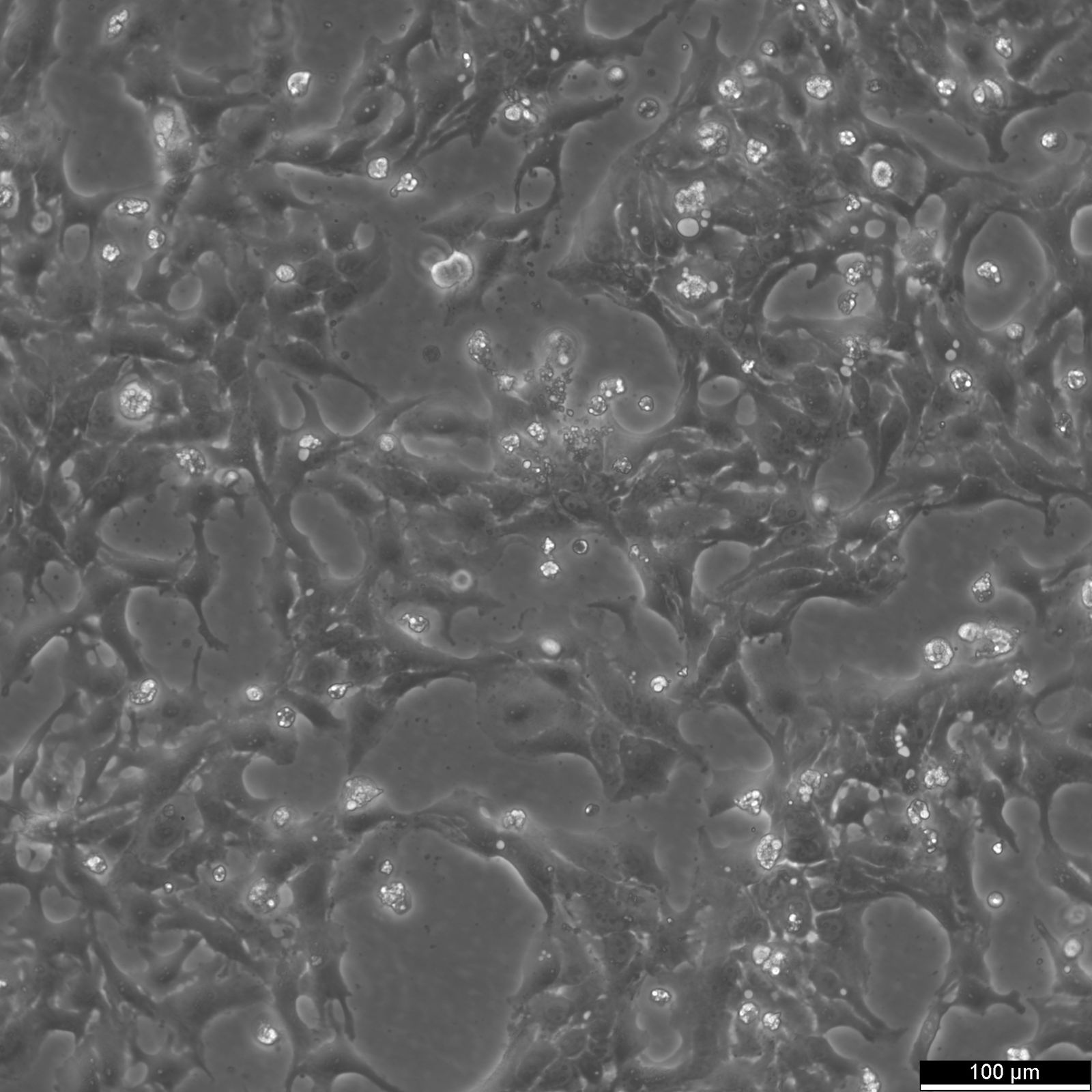 BT-20 Cells