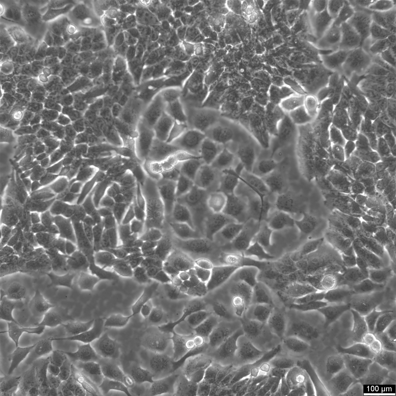 NCI-H358 Cells