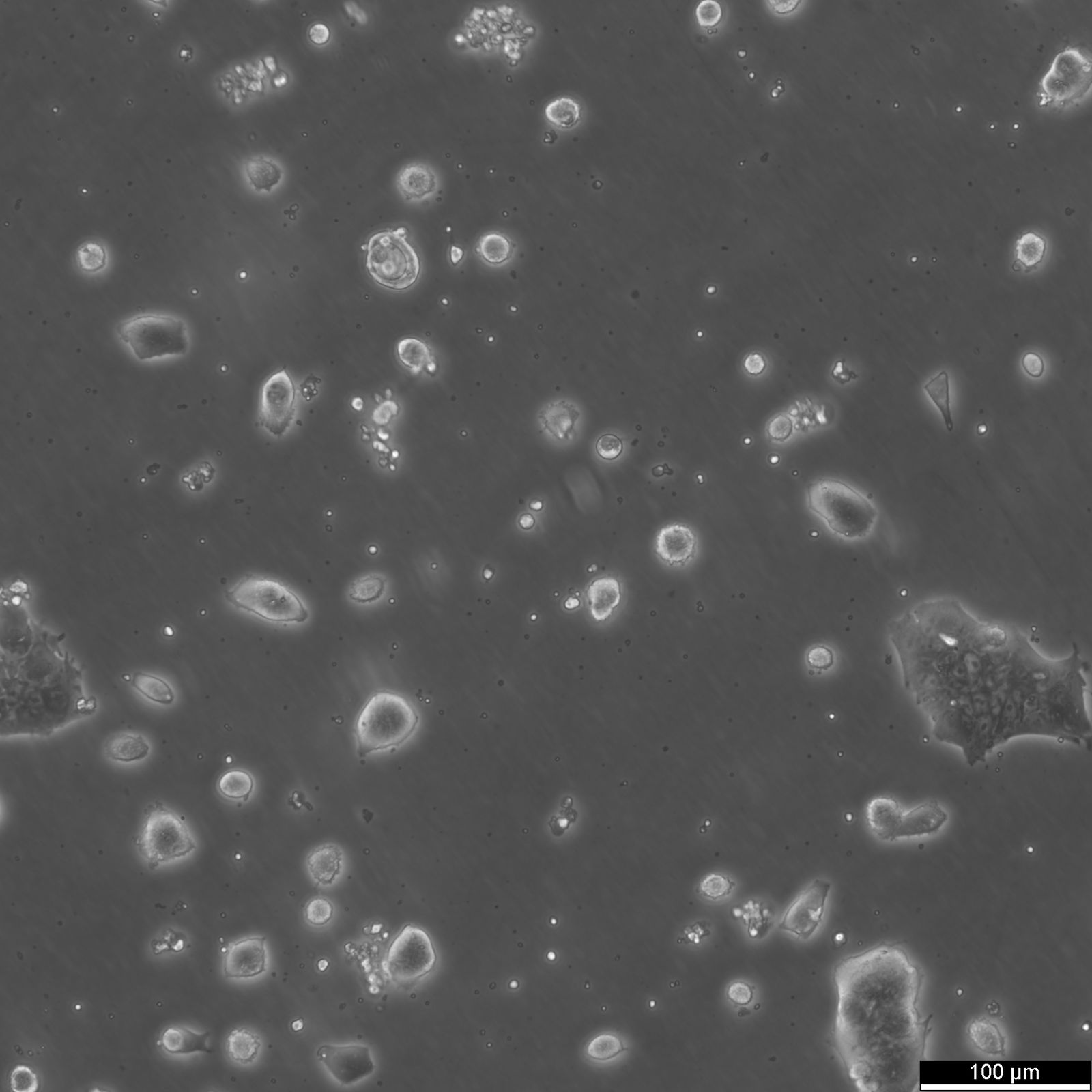 LS174T Cells LS174T Cells