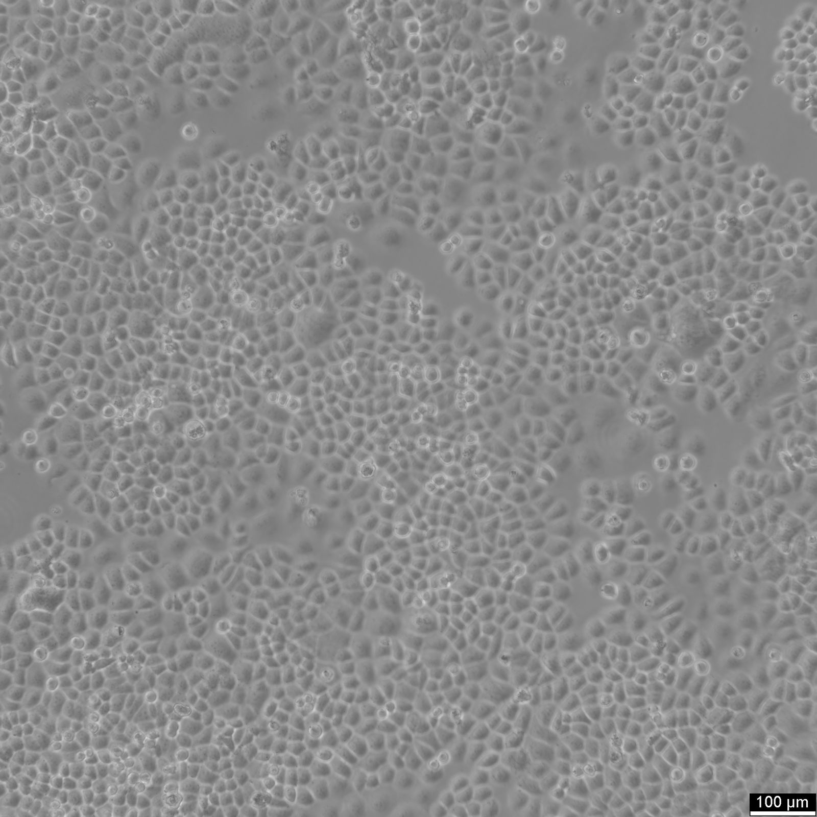 SW-13 Cells SW-13 Cells