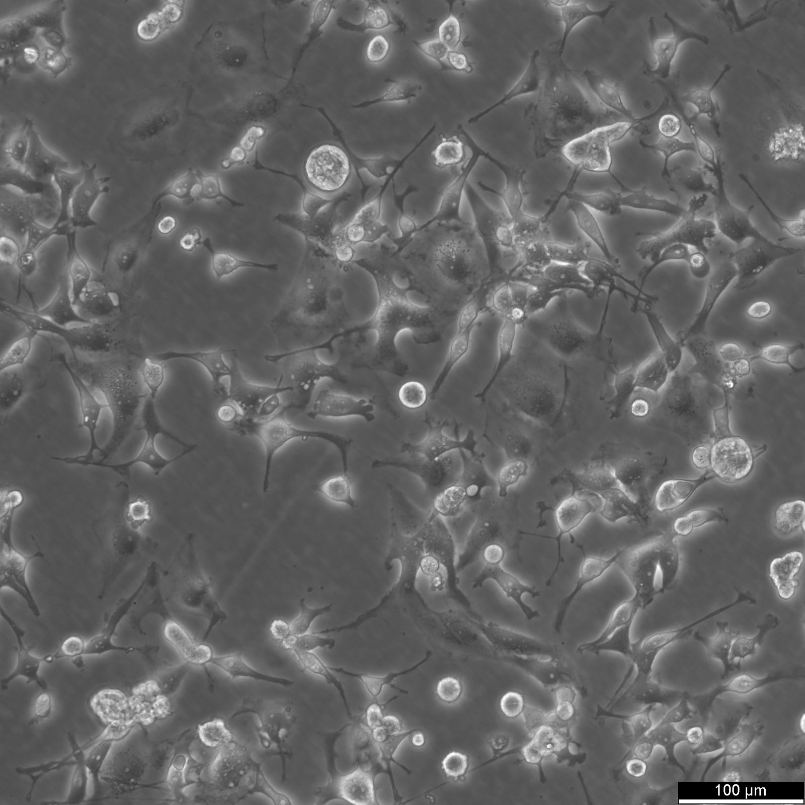 MDA-MB-436 Cells MDA-MB-436 Cells