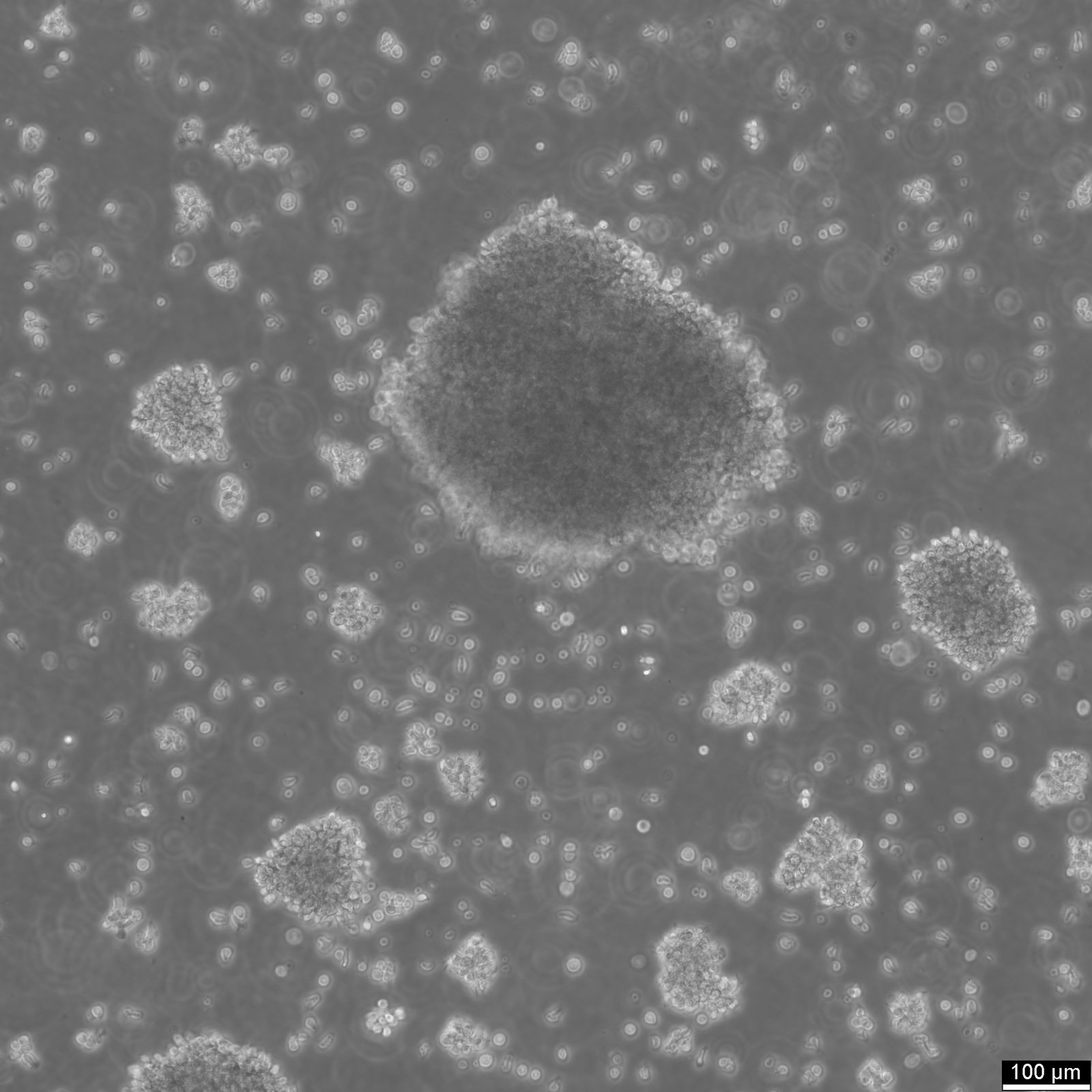 B-LCL-HROC69 Cells B-LCL-HROC69 Cells