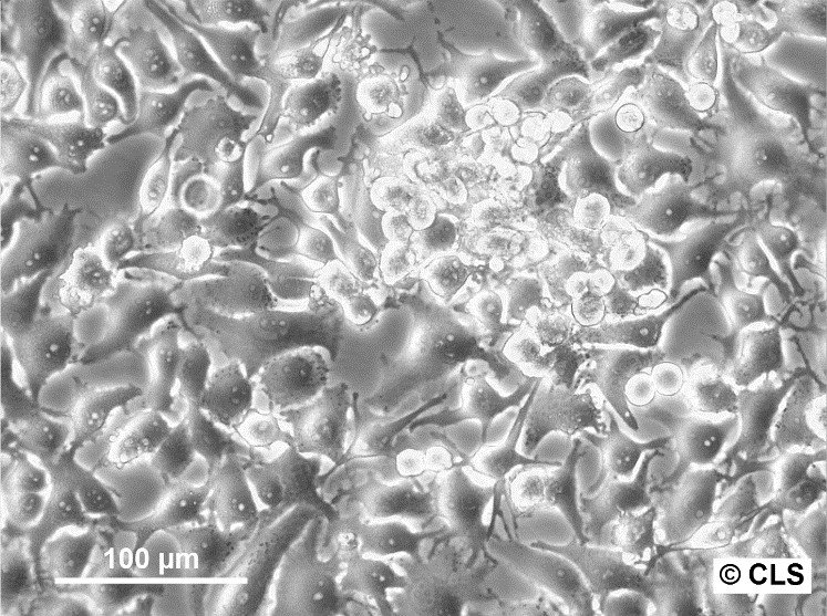 Cellules NCI-H295R