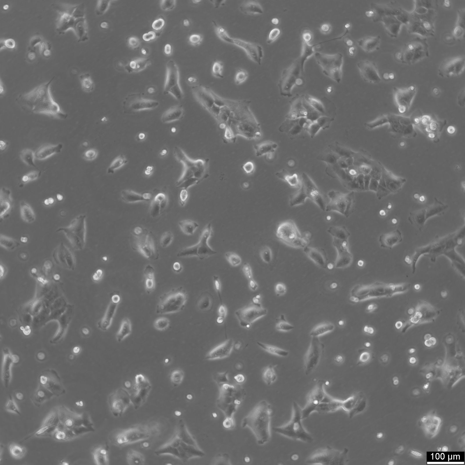 NCI-H2228 Cells NCI-H2228 Cells