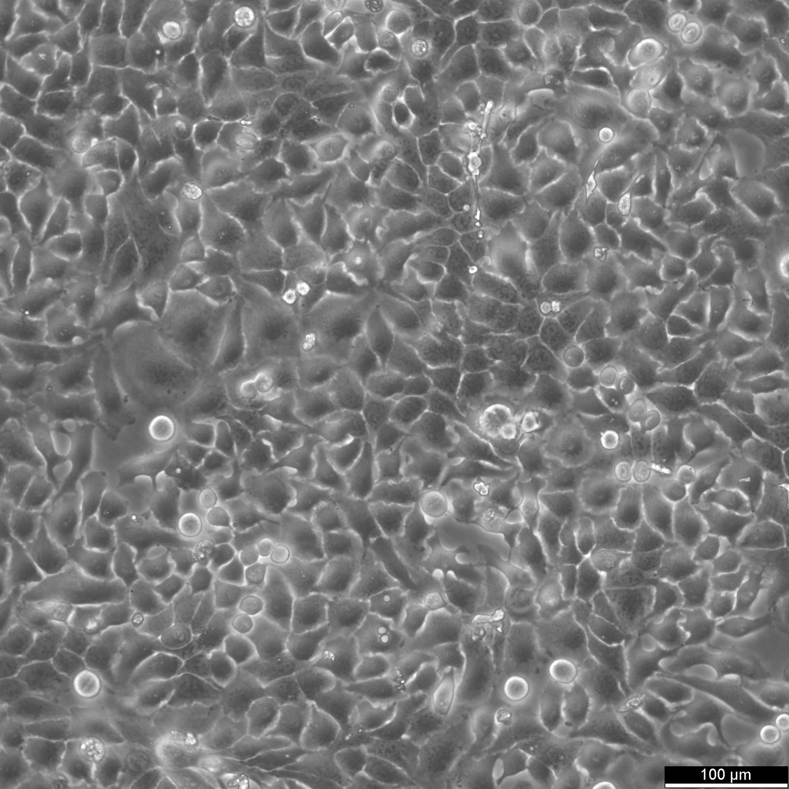 RT-112 Cells RT-112 Cells