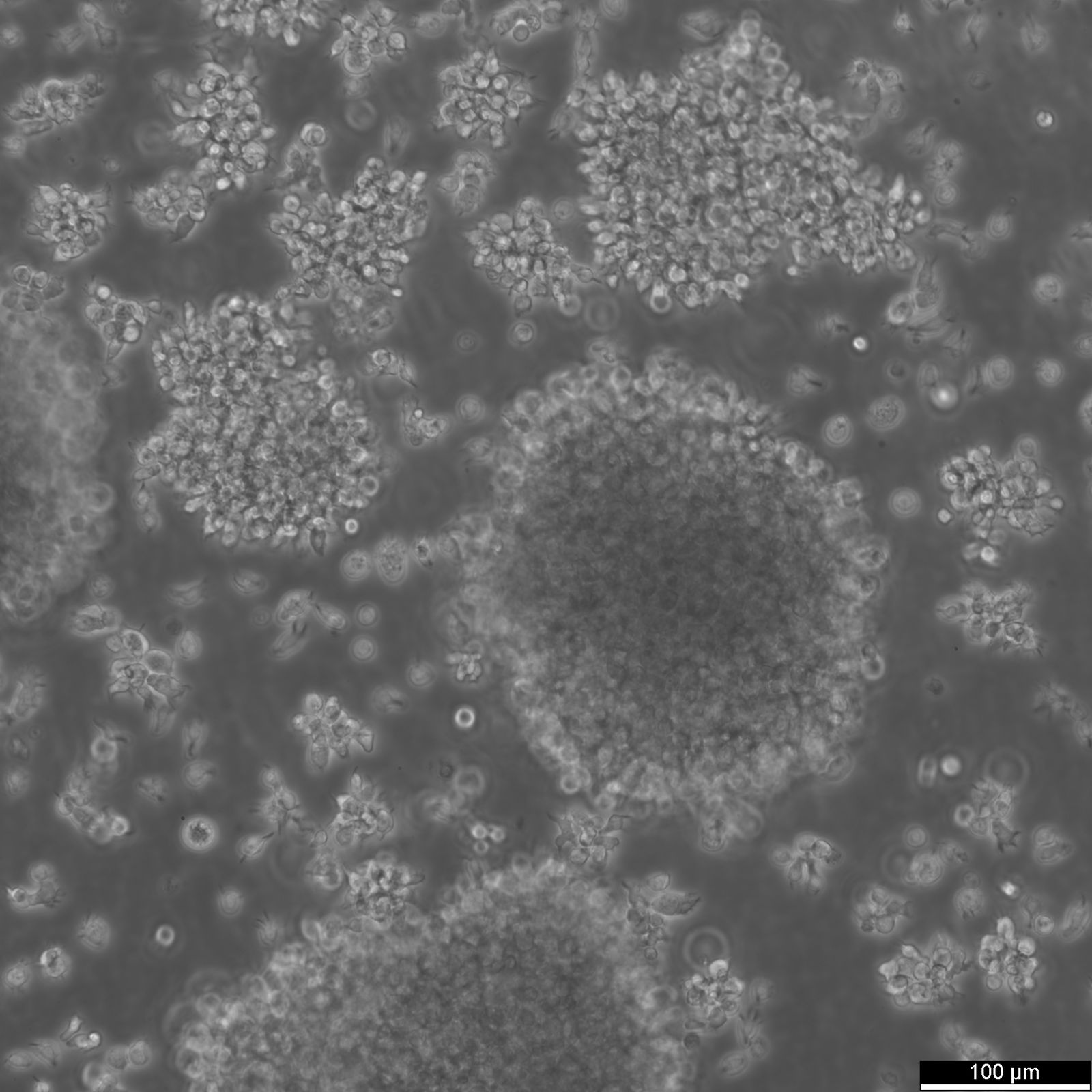 B-LCL-HROC69 Cells B-LCL-HROC69 Cells