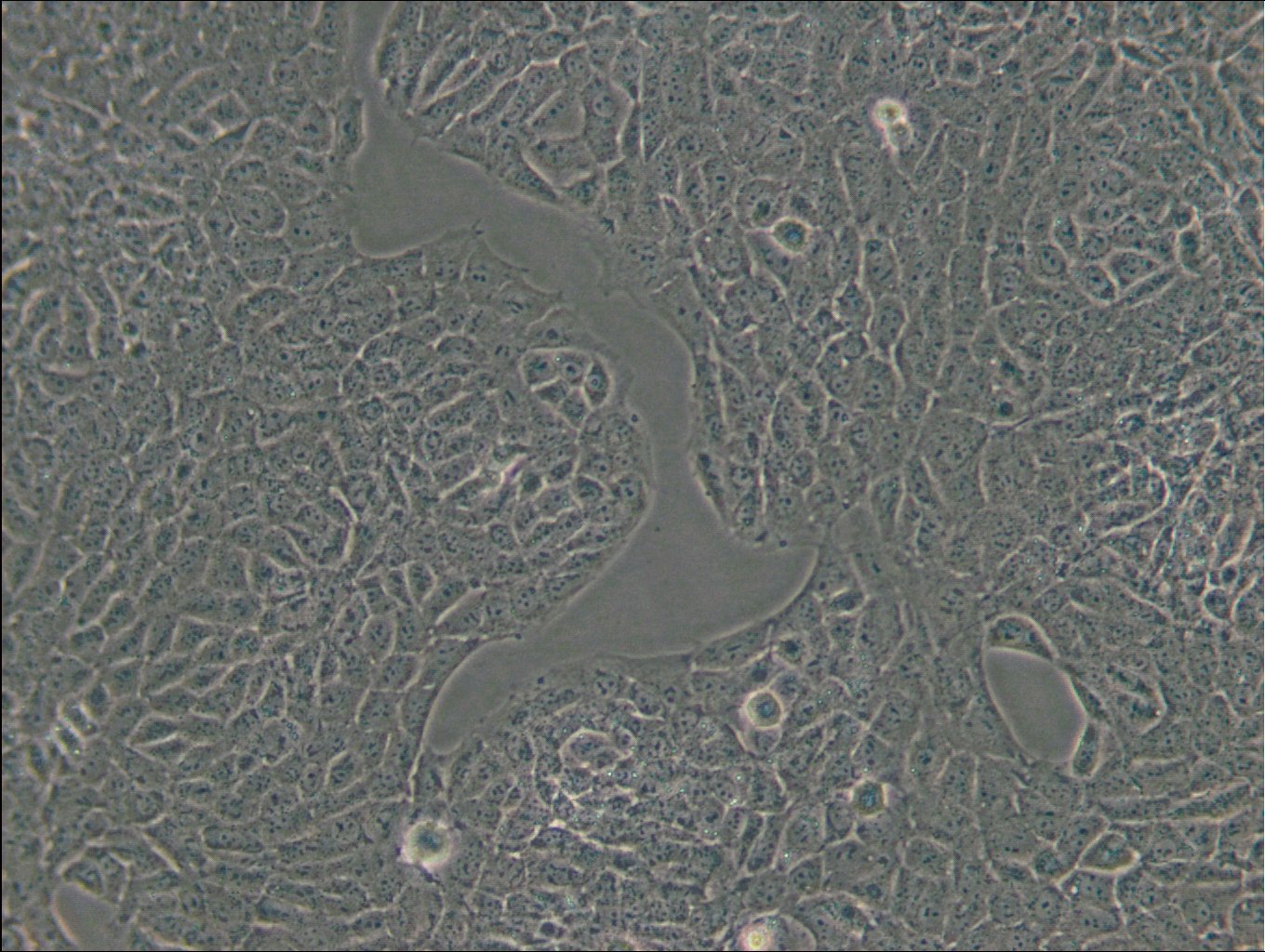 TM3 Cells
