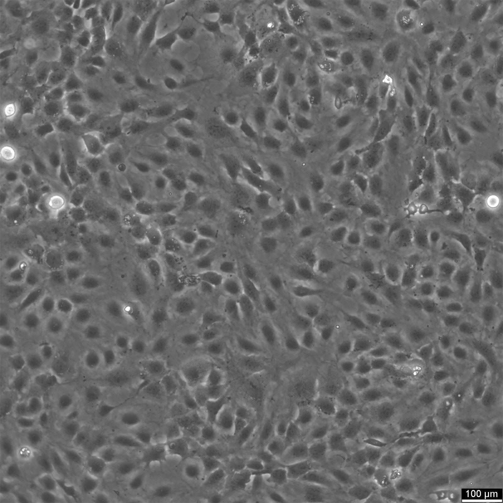 HMEC-1 Cells